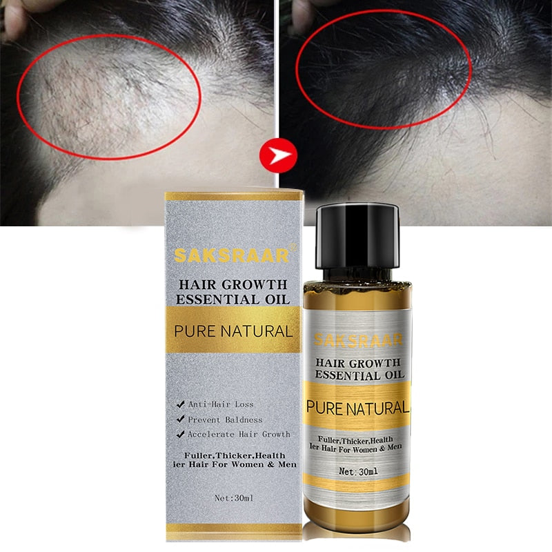 Hair Care Hair Growth Essential Oils Essence Original Authentic 100% Hair Loss Liquid Health Care Beauty Dense Hair Growth Serum