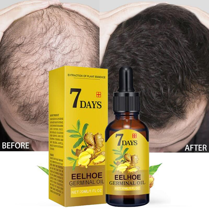 Hair Growth Products For Men Women Ginger Fast Growing Hair Essential Oil Beauty Hair Care Prevent Hair Loss Oil Scalp Treatment