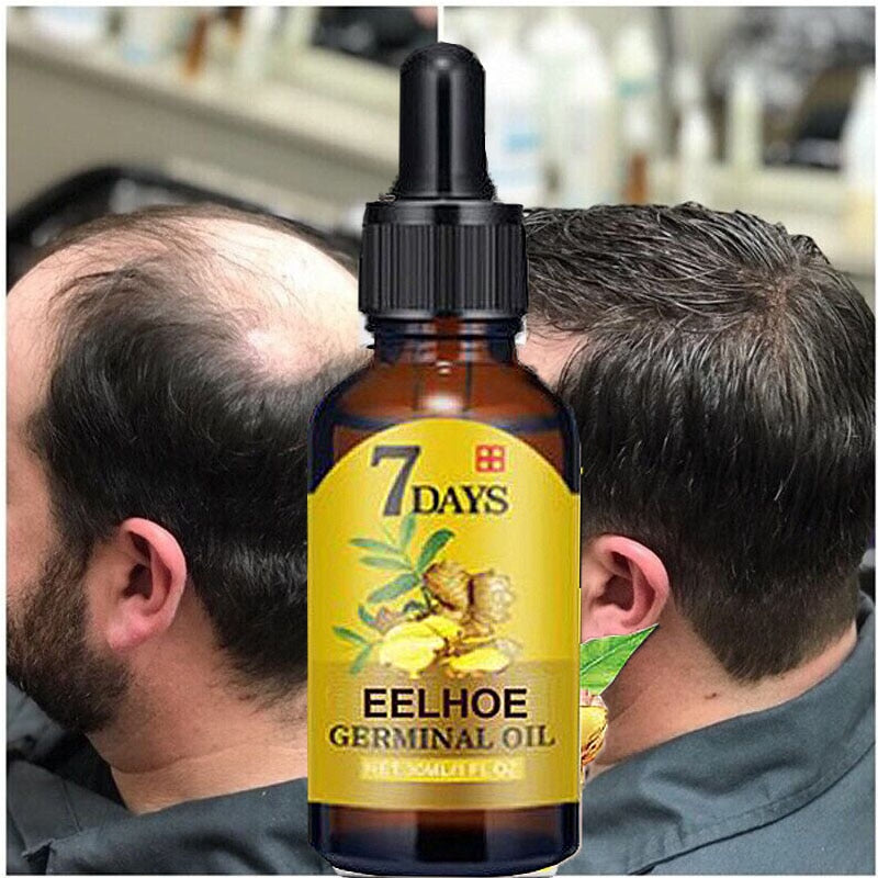 Hair Growth Products For Men Women Ginger Fast Growing Hair Essential Oil Beauty Hair Care Prevent Hair Loss Oil Scalp Treatment